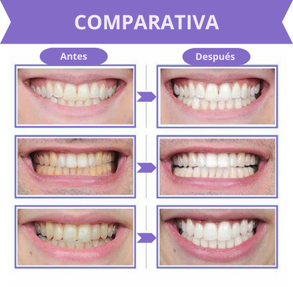 Blanqueador Dental Morado V34